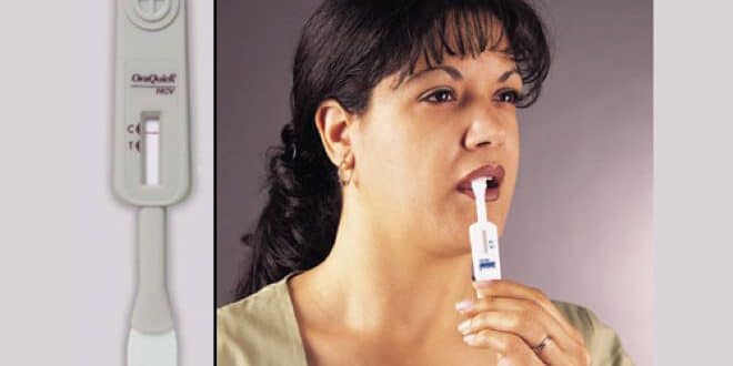 צהבת נגיפית: איך מזהים את המחלה ומי נמצא בסיכון?