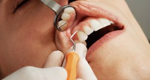 מדוע חשוב ללכת לרופא שיניים עם ניסיון