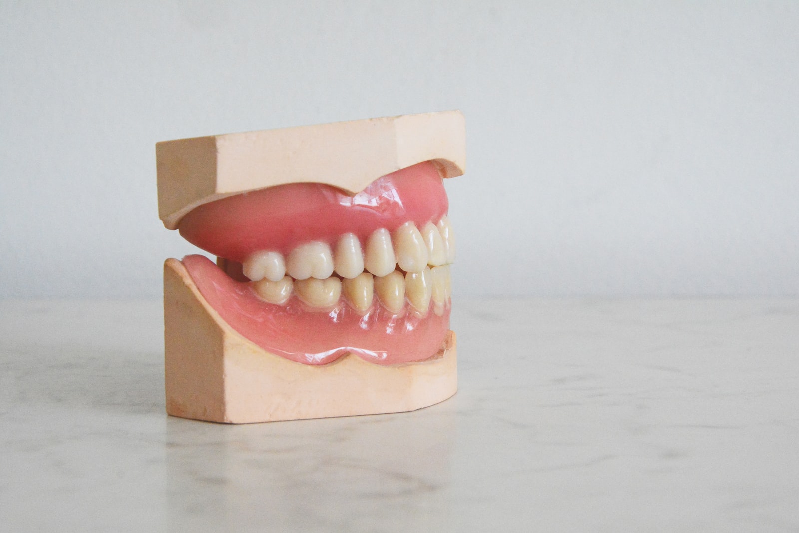 יישור שיניים בשיטה השקופה